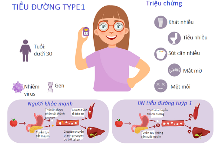 Các triệu chứng lâm sàng của đái tháo đường type 1 cũng giống như type2